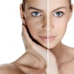 Botox niet alleen voor cosmetische behandelingen