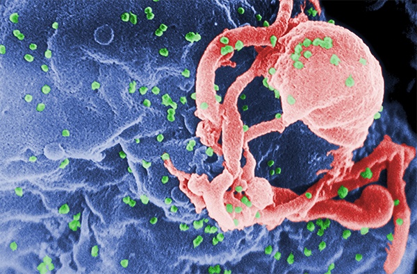 HIV binnenkort te genezen?