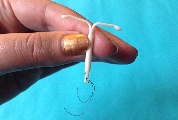 Gratis spiraaltje na een abortus is vanaf volgend jaar mogelijk